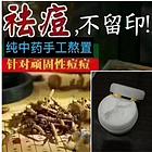 贵州苗药祛痘膏