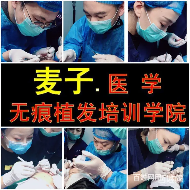 湖北孝感我学习植发的真实经历，现代植发技术培训的图片