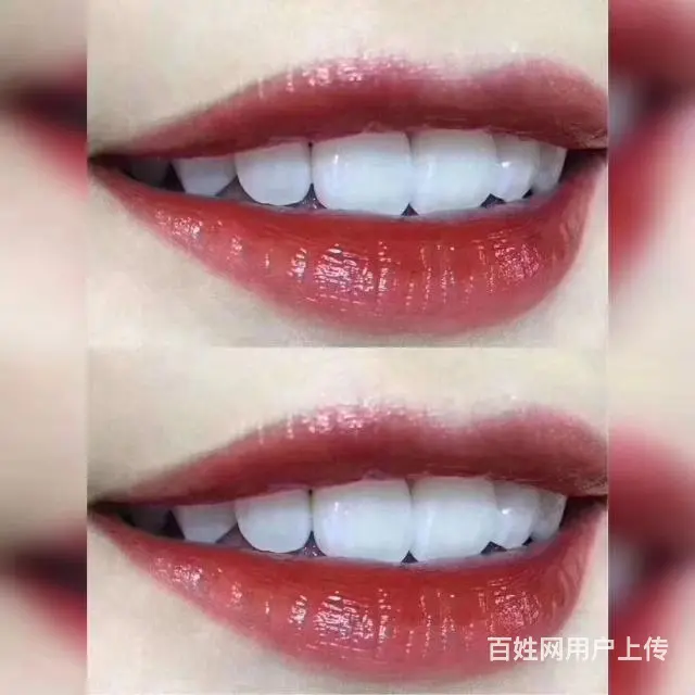 碧缇福美牙仪零售价多少钱，代理多少钱可以？ - 图片 1