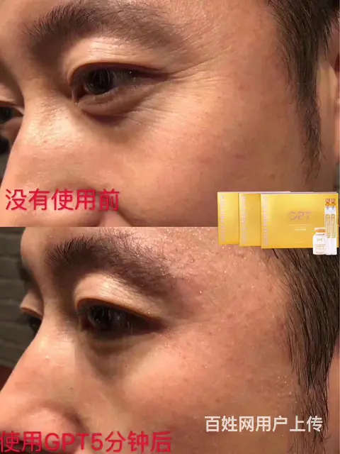 gpt黄金线雕全国招商 - 图片 6