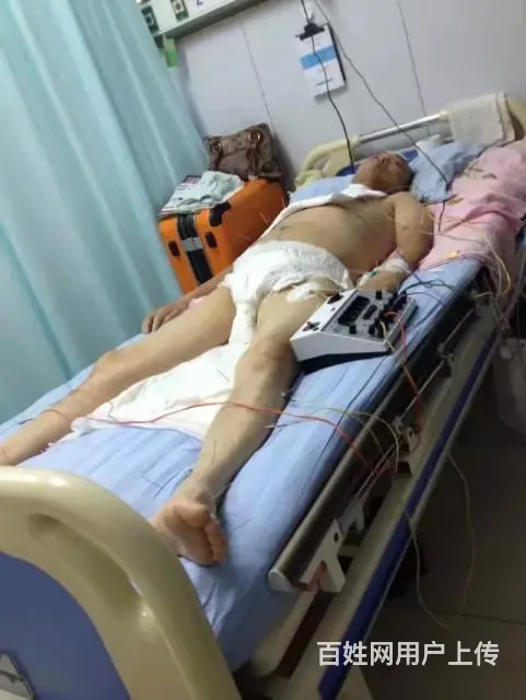 执业中医师上门针灸推拿康复 - 图片 2