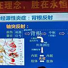 宫氏脑针公益高研班
