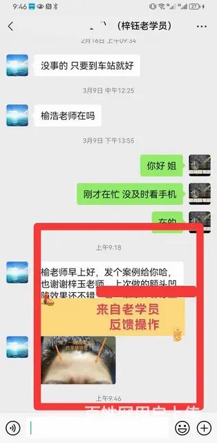 厦门针灸美雕技术 效果才是王道 - 图片 2