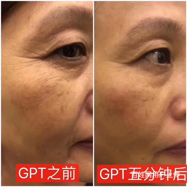 gpt黄金线雕全国招商 - 图片 4