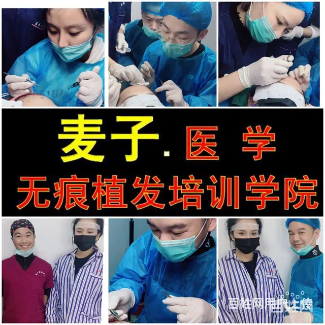 绍兴植发培训班多少费用，绍兴毛发移植培训技术班 - 图片 3