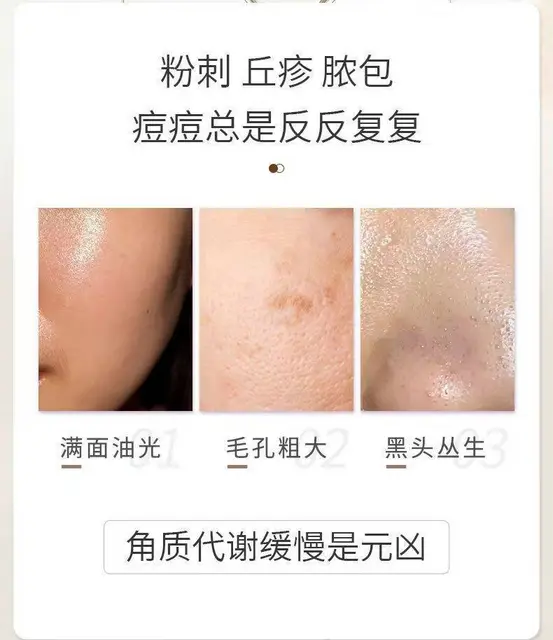 美妆批发代理，修氏乳糖酸毛孔紧致水 - 图片 2