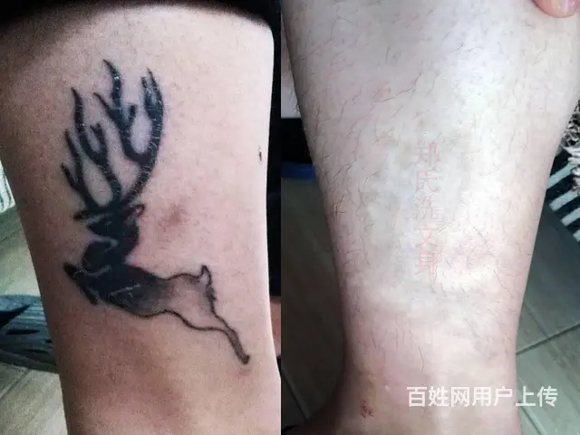 洗过多次洗不掉的纹身就到郑氏洗纹身 - 图片 3