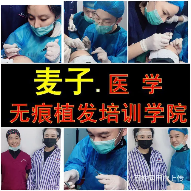 浙江绍兴植发哪里可以培训，浙江绍兴毛发移植培训班，浙江绍兴《 - 图片 3