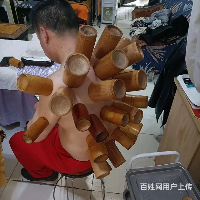 刮痧，按摩，针灸，正骨，洗脚，调理 - 图片 2