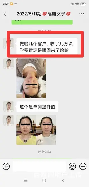 郑州一根针灸美雕技术 提升公益课领取中 - 图片 5