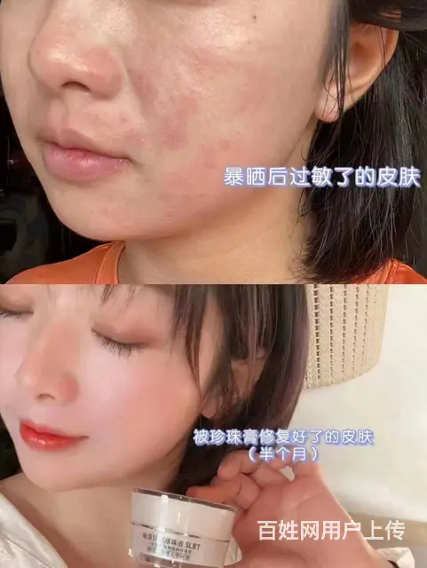 施洛贝缇珍珠膏代理价怎么拿 - 图片 11