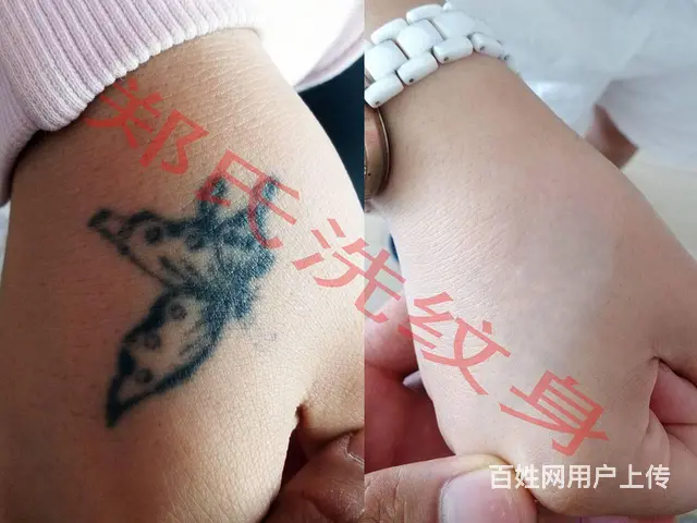 怎样选择洗纹身店可靠 - 图片 9