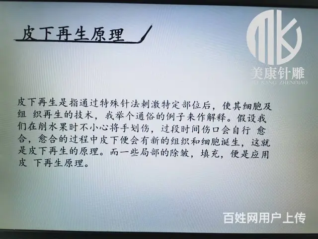 郑州针灸美雕的疗程是怎样的 - 图片 3