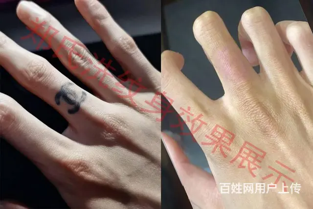 沈阳洗纹身一次性洗净纹身郑氏洗纹身包洗干净所有纹身 - 图片 7