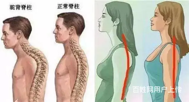 矫正驼背   八字脚 形体训练 - 图片